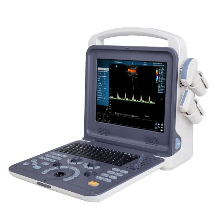 Sunbright Mobile Ultrasound Device by Scantrik