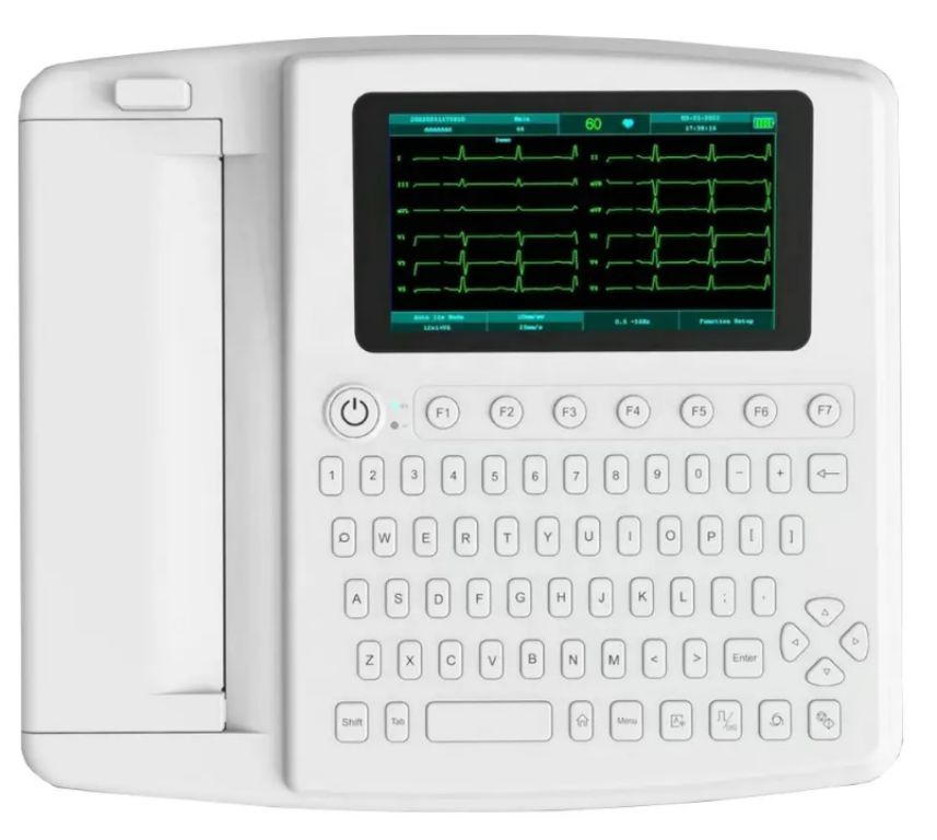 Cardiac Rhythm Analysis System by Scantrik