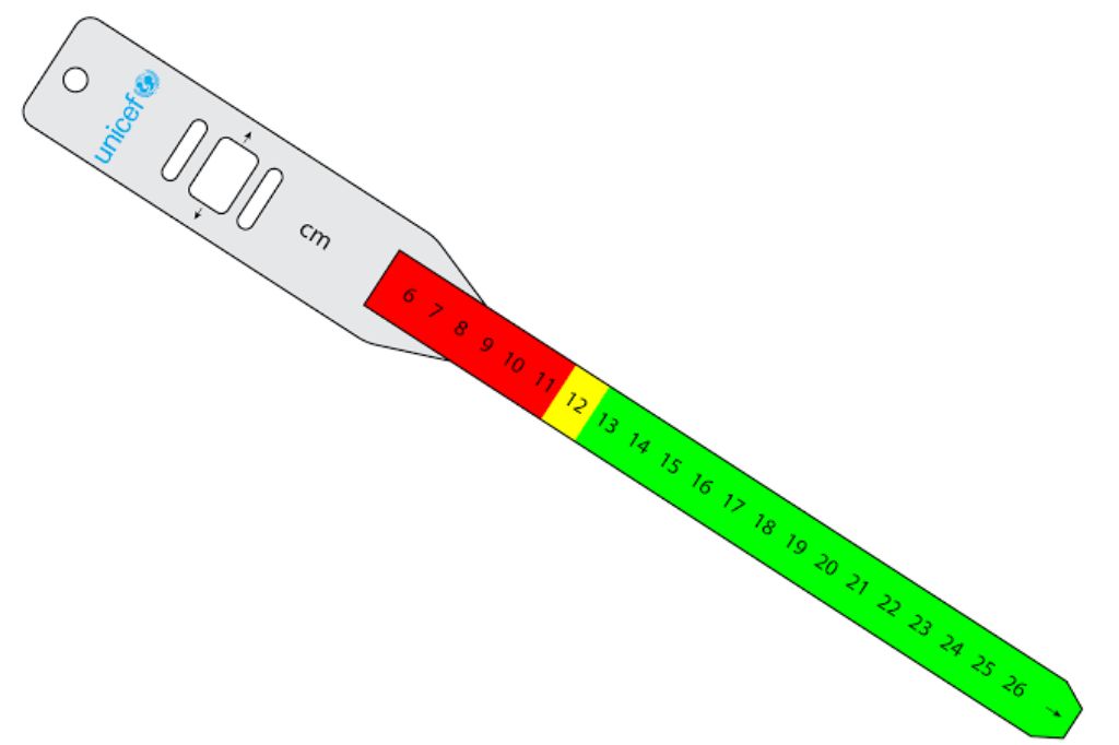PVC Tape by Scantrik